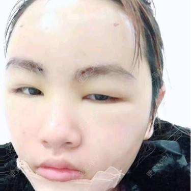 硅胶垫下巴