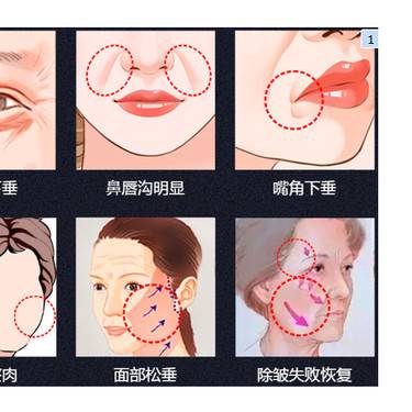 微拉美