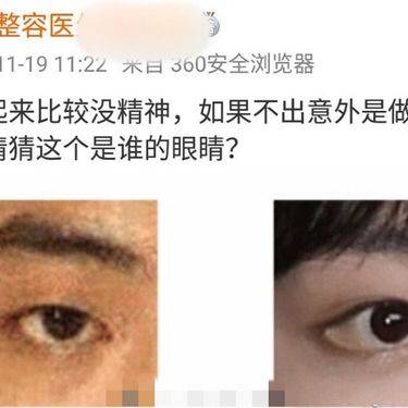 眼睑下至