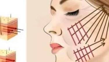 悦升线