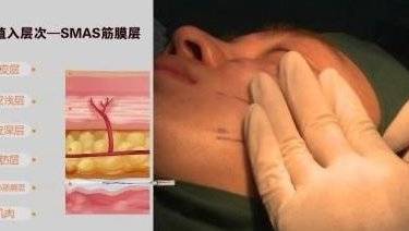 悦升线