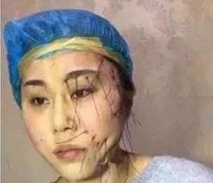 悦升线