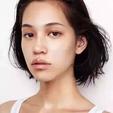 凸嘴矫正