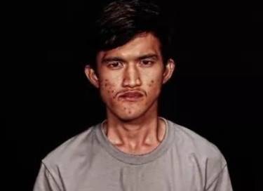 泰国丑男整成韩国帅欧巴和变性女友不离不弃