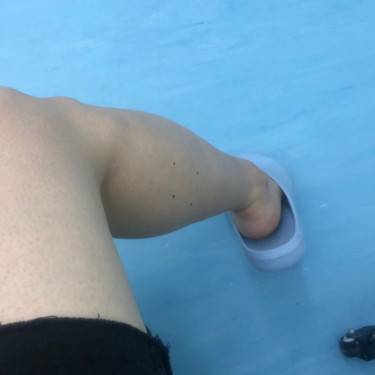 注射塑形腿部