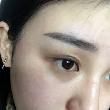 皮秒激光