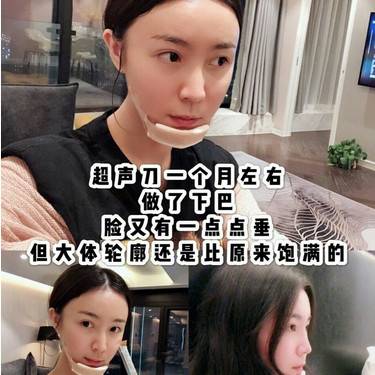 超声提升