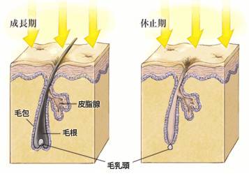激光脱毛