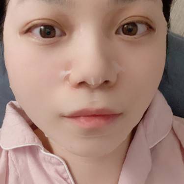 超声提升