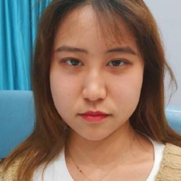 超声提升