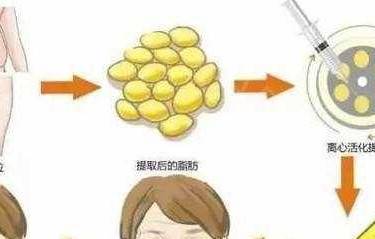 祛黑眼圈