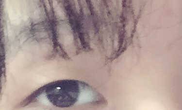 开眼角