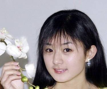植发际线