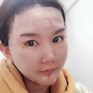 除皱