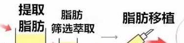 硅胶垫下巴