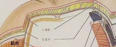 硅胶垫下巴