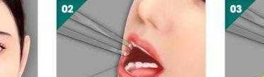 酒窝