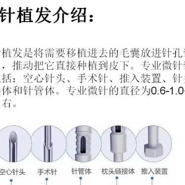 植发际线