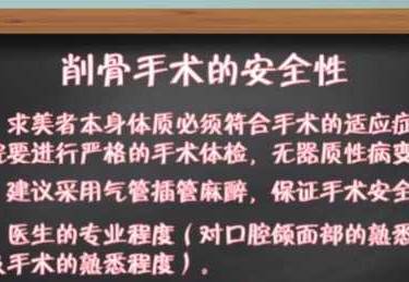 颧骨颧弓整形