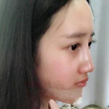 硅胶垫下巴
