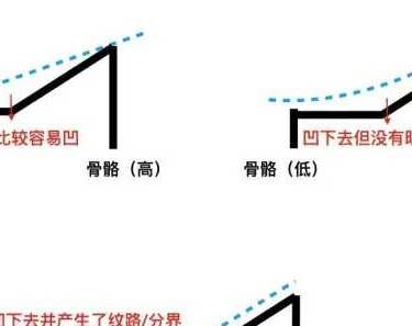 除皱