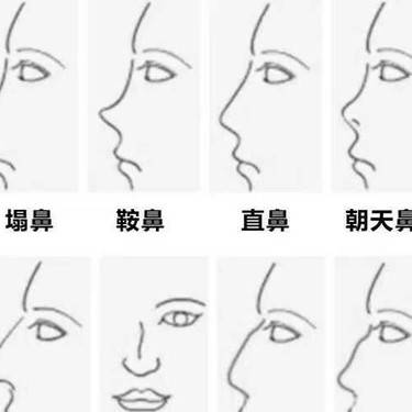 耳软骨隆鼻