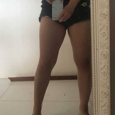 冷冻溶脂