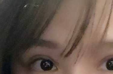 开眼角