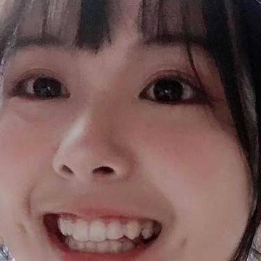 酒窝成形