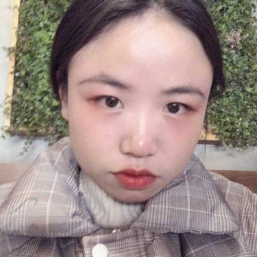 耳软骨隆鼻