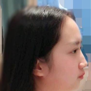 硅胶垫下巴