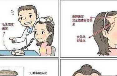 植发际线
