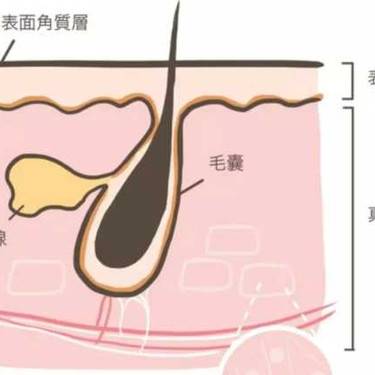 点阵激光