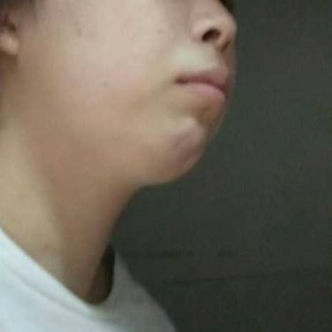下巴