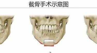 下巴