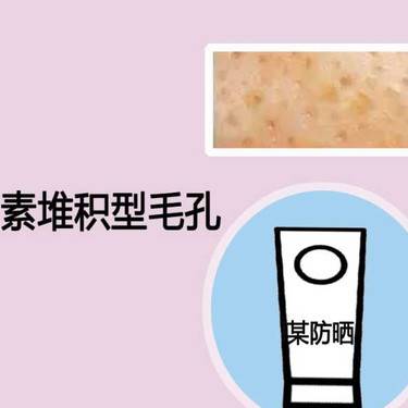 点阵激光