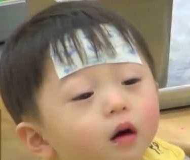 激光点痣