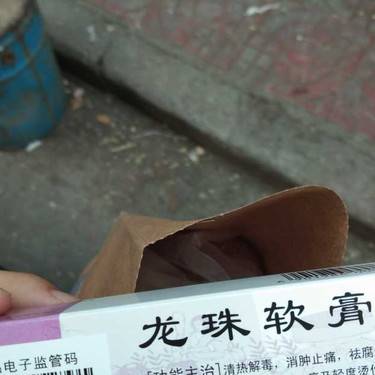 激光点痣