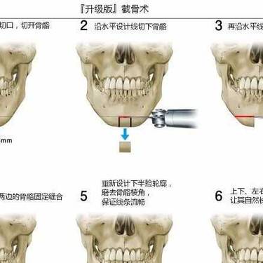 下巴