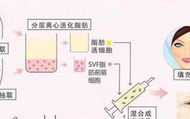 自体脂肪