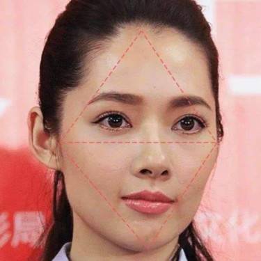 颧骨颧弓