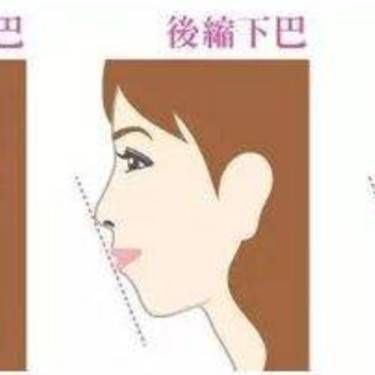 硅胶垫下巴