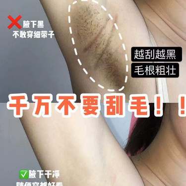 小腿脱毛