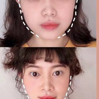 除皱瘦脸