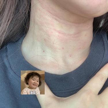 水光娃娃