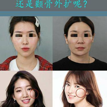 太阳穴