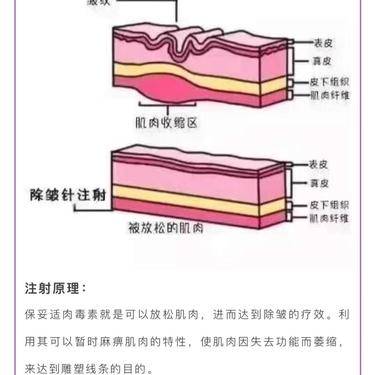 眼部护理