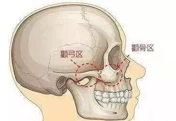 颧骨眶突图片