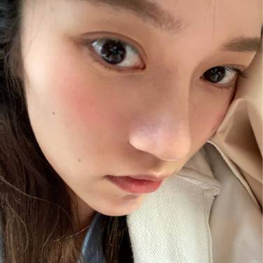 宽鼻矫正