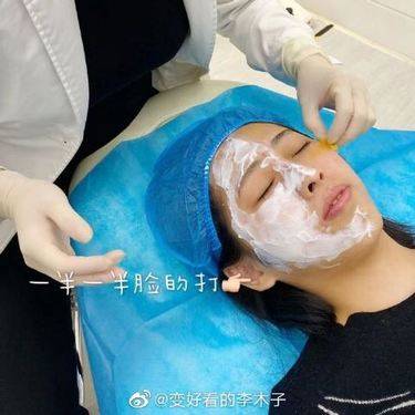 胶原蛋白改善面部细纹